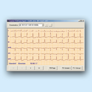 CardioTEKA – oprogramowanie v.001 Oprogramowanie do elektrokardiografów