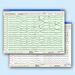 AsTEK EEG 3M Alfa System v.001 Oprogramowanie do systemów EEG