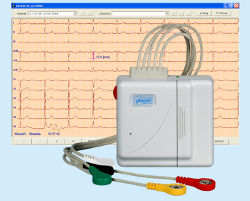 CardioTEL Alfa System NET v.001 Cyfrowy nadajnik sygnału EKG wraz z oprogramowaniem