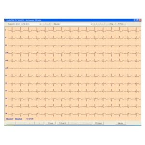 Aparaty EKG  CardioTEKA – oprogramowanie – HL7