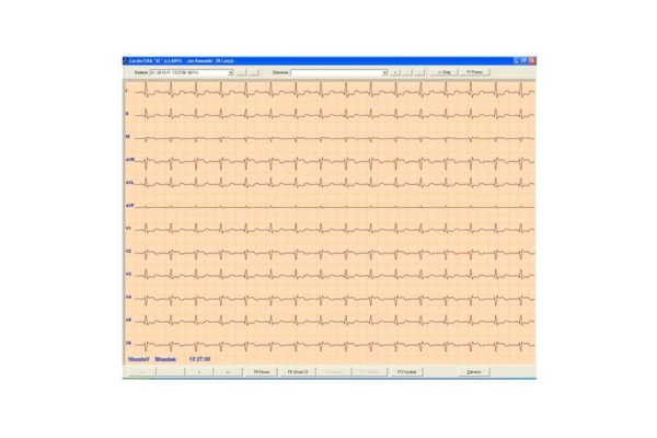 Aparaty EKG CardioTEKA - Oprogramowanie