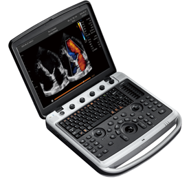 USG Chison SonoBook 8.